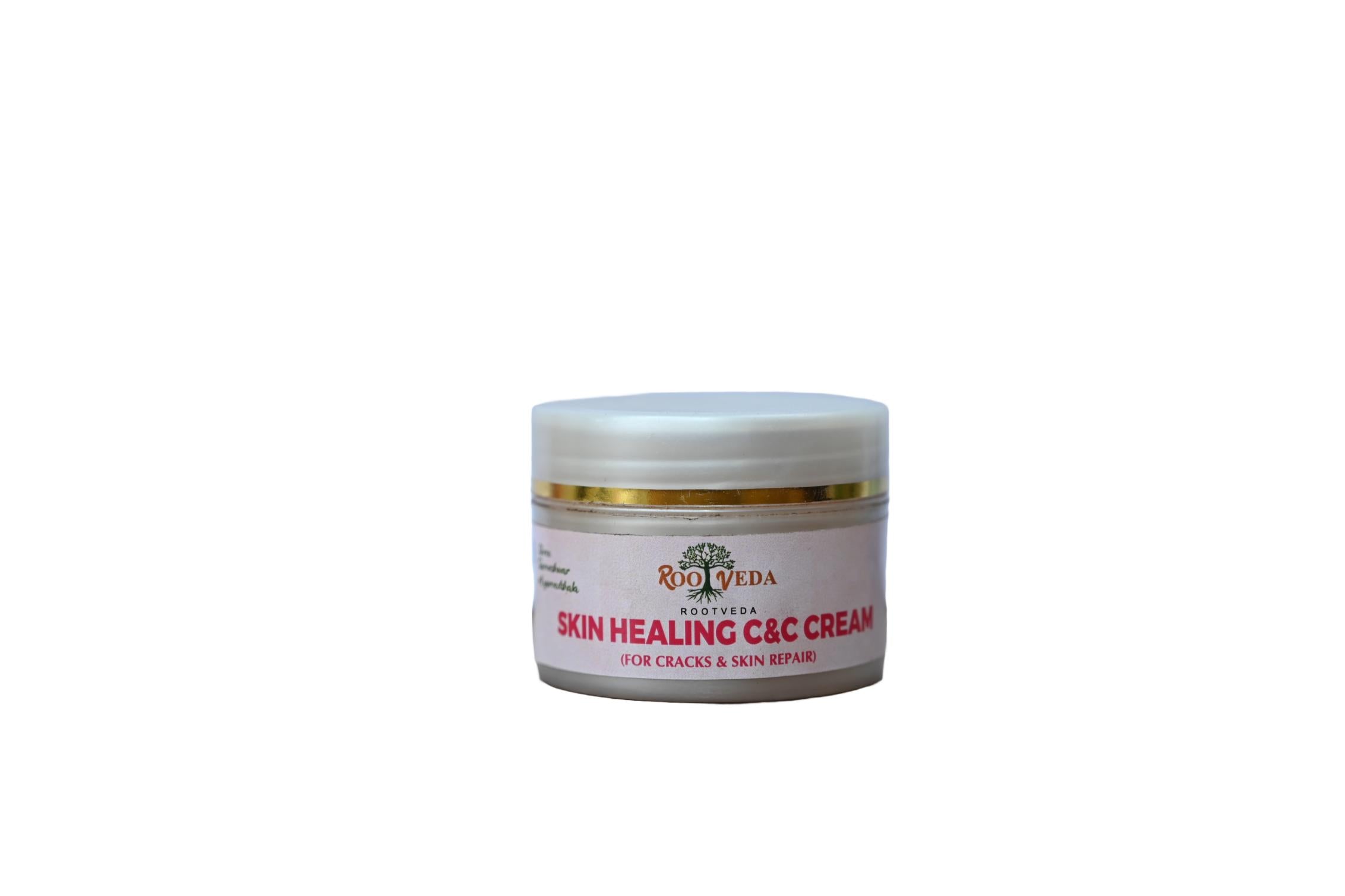 ROOTVEDA Skin Healing C and C Cream Tube of 50 GM